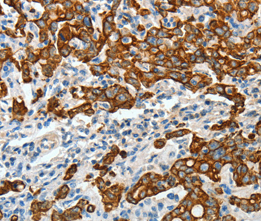 CK-18 Polyclonal Antibody (E-AB-10142)