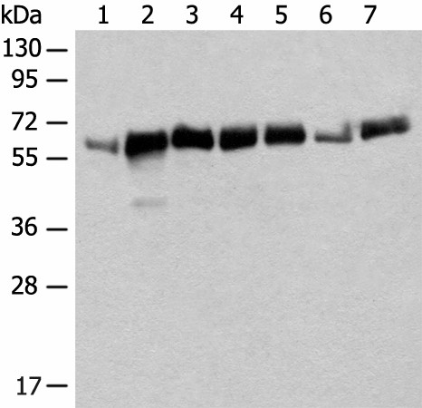 CCDC47 Polyclonal Antibody (E-AB-18732)