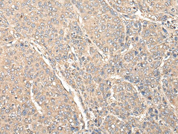 C1orf106 Polyclonal Antibody (E-AB-18563)