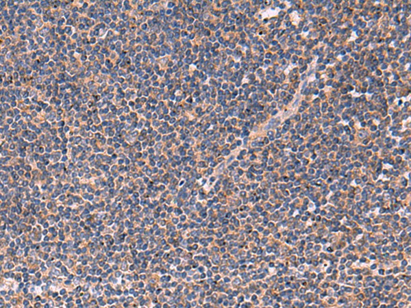 JPH2 Polyclonal Antibody (E-AB-52060)