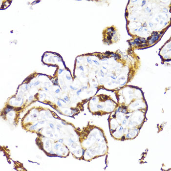 HSD17B1 Polyclonal Antibody (E-AB-65790)