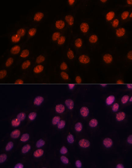 IPO8 Polyclonal Antibody (E-AB-65070)