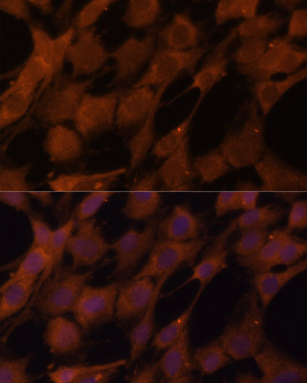 LGMN Polyclonal Antibody (E-AB-65780)