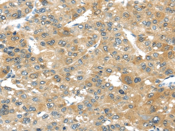TMPRSS4 Polyclonal Antibody (E-AB-17112)