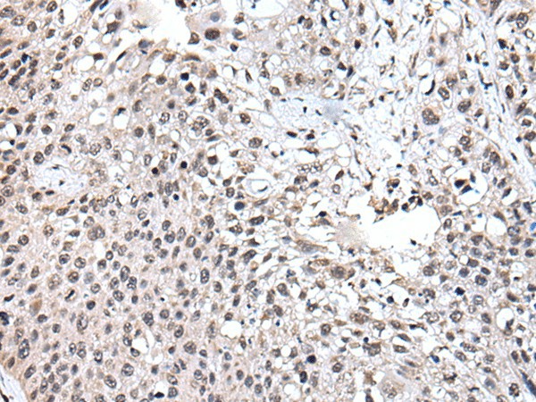 UBE2E3 Polyclonal Antibody (E-AB-52434)