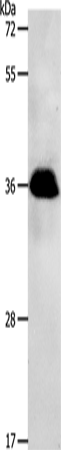PPP2CB Polyclonal Antibody (E-AB-12845)