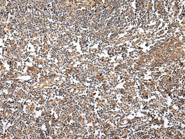 VSIG8 Polyclonal Antibody (E-AB-17258)