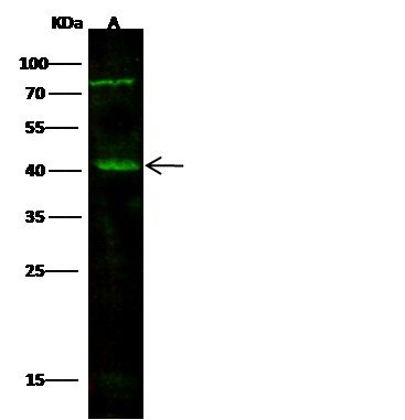 VE-Cadherin/CD144/CDH5 Monoclonal Antibody (AN200252P)