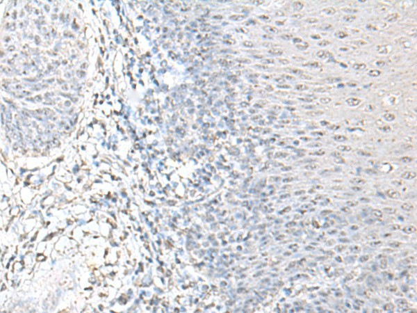 EPM2A Polyclonal Antibody (E-AB-18758)