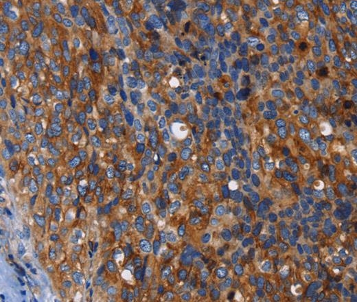 MSLN Polyclonal Antibody (E-AB-10472)