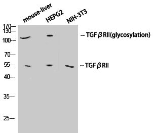 TGF β Receptor II Polyclonal Antibody (E-AB-33088)