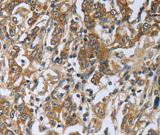 PRL Polyclonal Antibody (E-AB-14317)