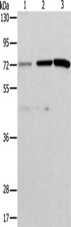 ALS2CR11 Polyclonal Antibody (E-AB-10786)