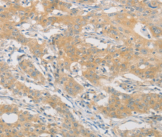 HIPK4 Polyclonal Antibody (E-AB-14679)