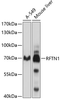 RFTN1 Polyclonal Antibody (E-AB-90163)
