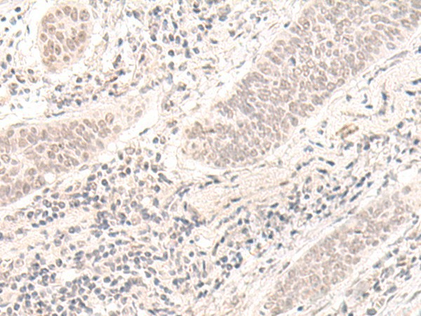 ZBED1 Polyclonal Antibody (E-AB-52662)