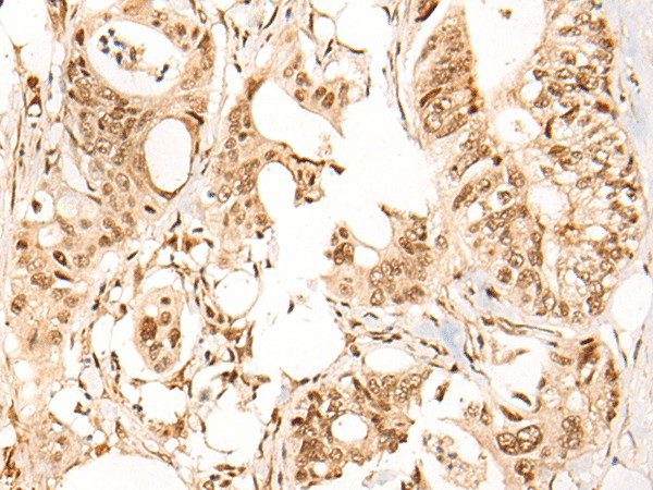 ARID1B Polyclonal Antibody (E-AB-19320)