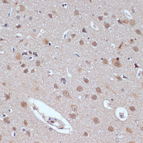 TP53BP2 Polyclonal Antibody (E-AB-68376)