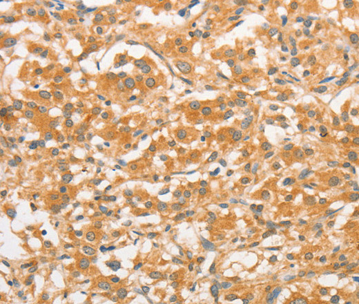 TLR3 Polyclonal Antibody (E-AB-10875)