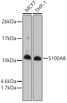 S100A8 Polyclonal Antibody (E-AB-66971)