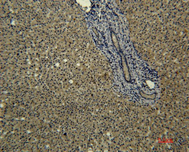 Transferrin Monoclonal Antibody (E-AB-22193)