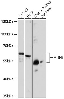 A1BG Polyclonal Antibody (E-AB-64079)
