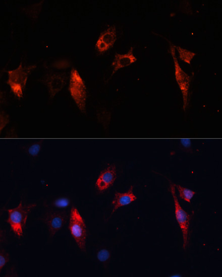 CTSL Polyclonal Antibody (E-AB-65869)