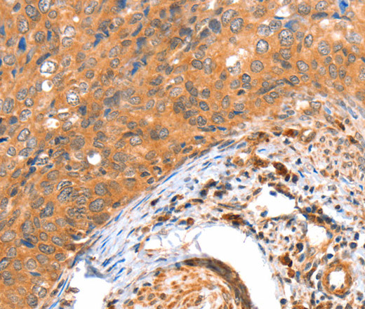 ACOX3 Polyclonal Antibody (E-AB-14480)