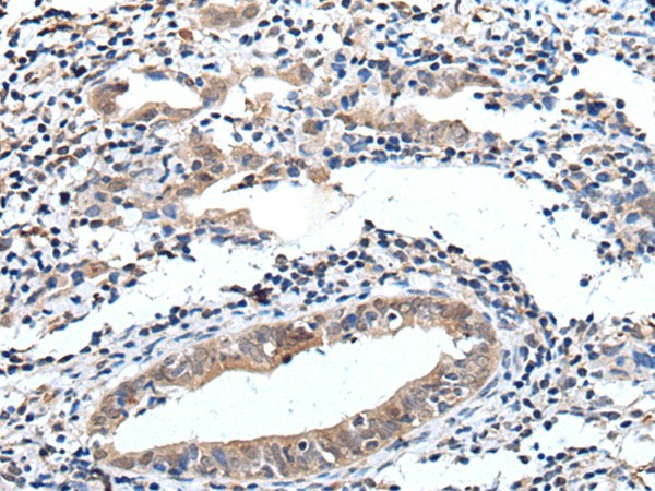ELMO1 Polyclonal Antibody (E-AB-52186)