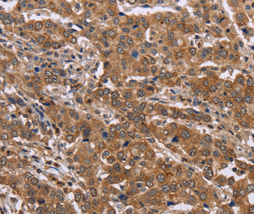 FAAH2 Polyclonal Antibody (E-AB-11206)