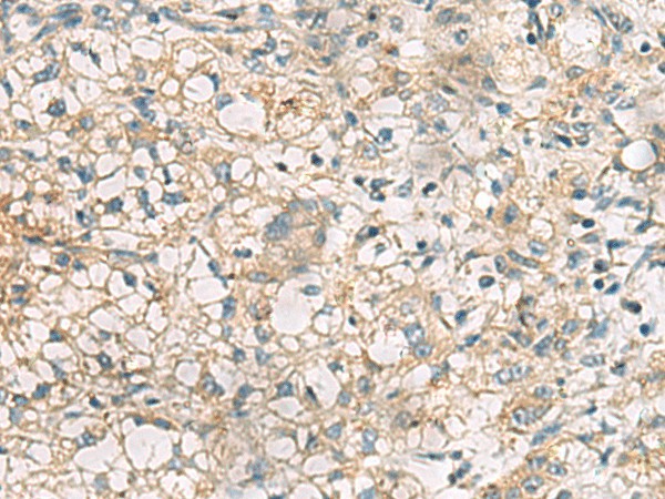RTP4 Polyclonal Antibody (E-AB-53110)