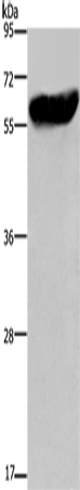 CYP2E1 Polyclonal Antibody (E-AB-11118)