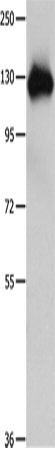 Amphiphysin I Polyclonal Antibody (E-AB-10128)