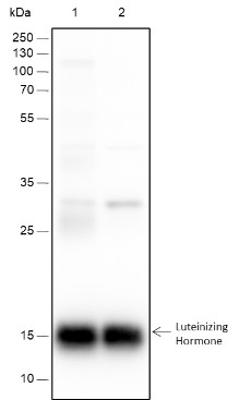 Recombinant Luteinizing Hormone beta Monoclonal Antibody (AN301590L)