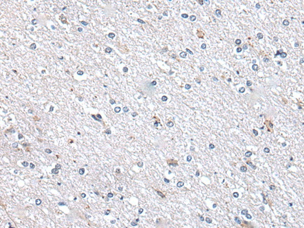 METTL7A Polyclonal Antibody (E-AB-52354)