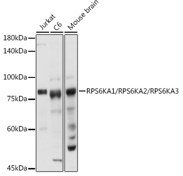 RPS6KA1/RPS6KA2/RPS6KA3 Polyclonal Antibody (E-AB-92216)