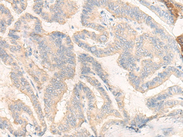 COG4 Polyclonal Antibody (E-AB-52652)