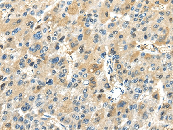 TRAIP Polyclonal Antibody (E-AB-17152)