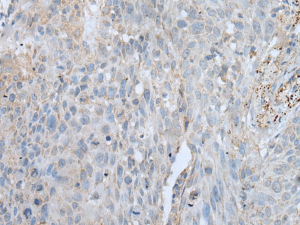 VWA2 Polyclonal Antibody (E-AB-52426)