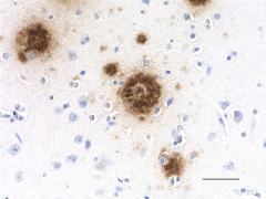 Purified anti-β-Amyloid, 1-40 Antibody (Previously Covance catalog# SIG-39140) (805409)
