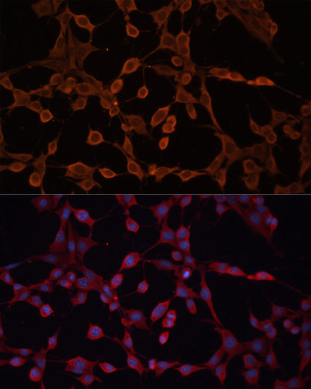 ABCB11 Polyclonal Antibody (E-AB-63882)
