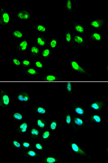 FCGR2A Polyclonal Antibody (E-AB-66157)