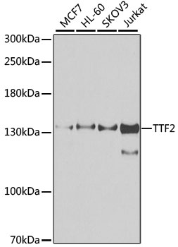 TTF2 Polyclonal Antibody (E-AB-62278)