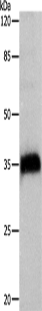 CTSZ Polyclonal Antibody (E-AB-13977)