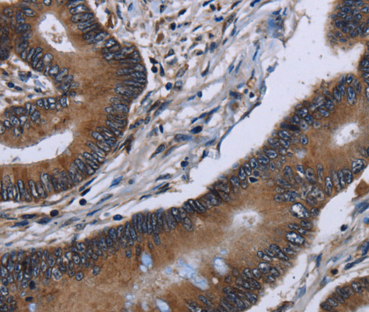 ITGAE Polyclonal Antibody (E-AB-15139)