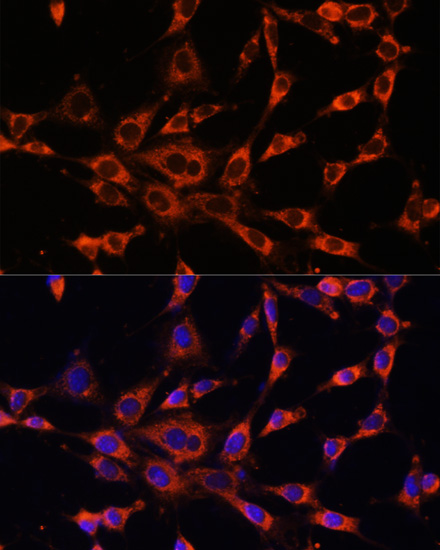 ITPR3 Polyclonal Antibody (E-AB-64330)