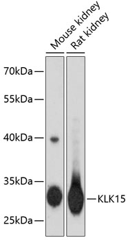 KLK15 Polyclonal Antibody (E-AB-65415)