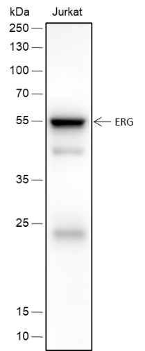 Recombinant ERG Monoclonal Antibody (AN301715L)