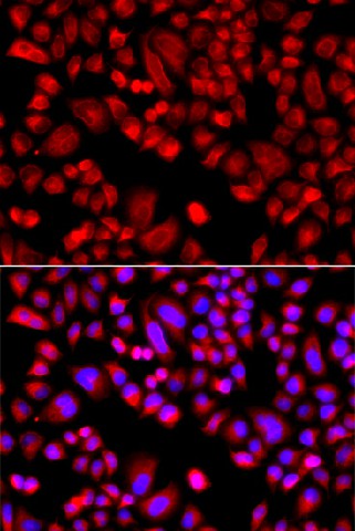 ARPC3 Polyclonal Antibody (E-AB-63021)