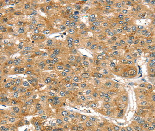 RASSF9 Polyclonal Antibody (E-AB-11523)